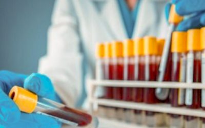 PABRIK DI KABUPATEN BOGOR KESULITAN LAKUKAN RAPID TEST MANDIRI