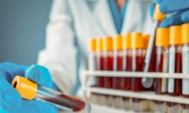 MENKES TERBITKAN ATURAN BARU, RAPID TEST HANYA UNTUK SITUASI KHUSUS