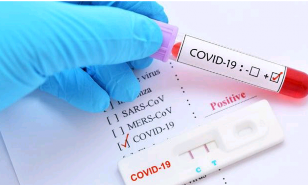 KEMENKES TETAPKAN TARIF MAKSIMAL RAPID TEST COVID-19